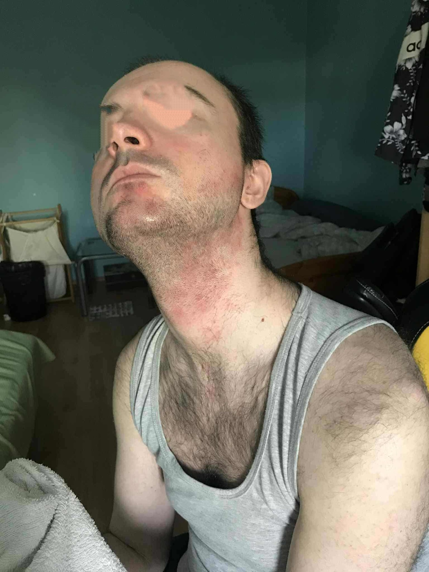 Gonfozottunk: fiatal férfi aki étkezési problémával küzd